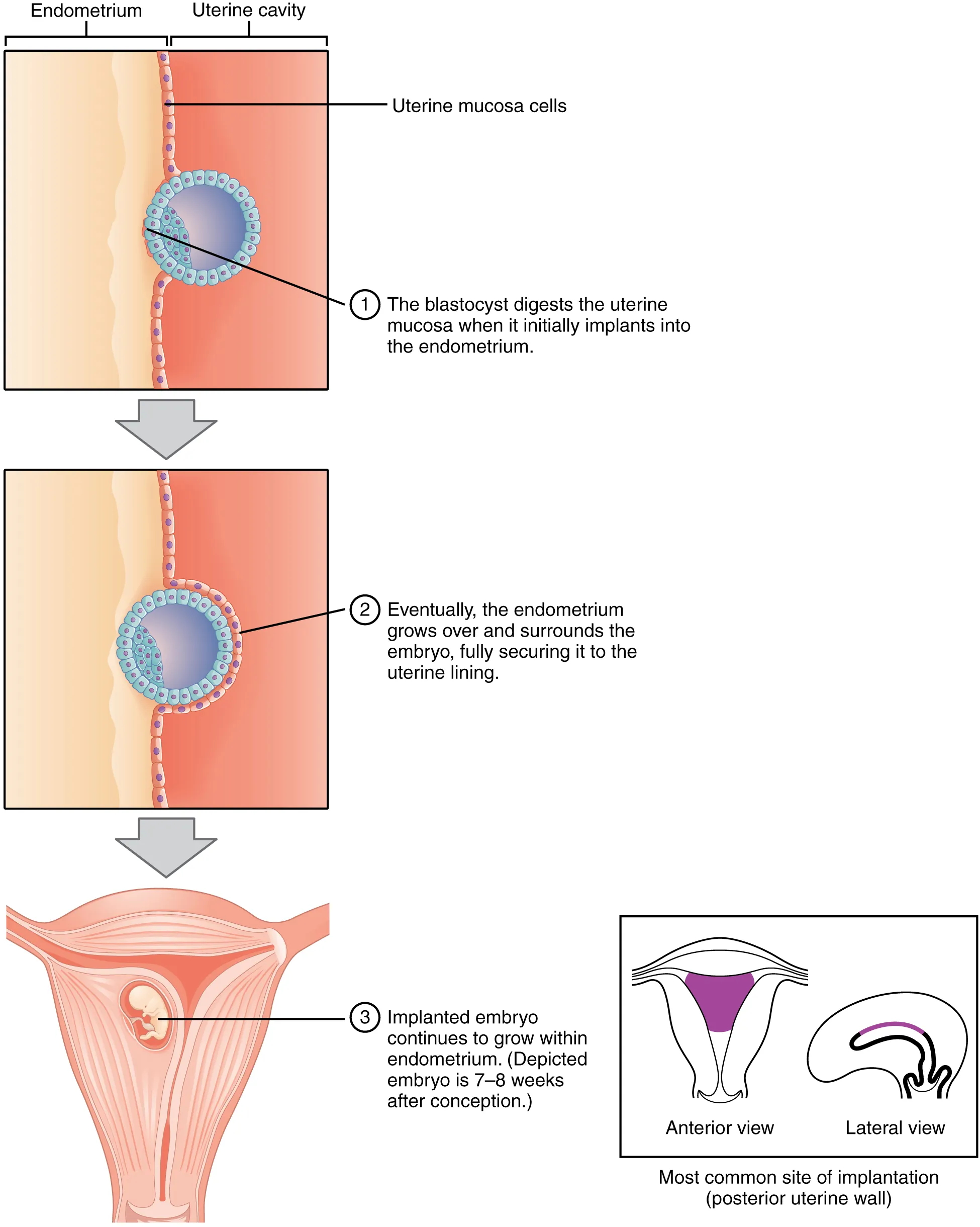 This figure shows the different steps during implantation. The top panel shows how the blastocyst burrows into the endometrium. The middle panel shows the blastocyst completely surrounded by the endometrium. The bottom panel shows the implanted embryo growing in the uterus.