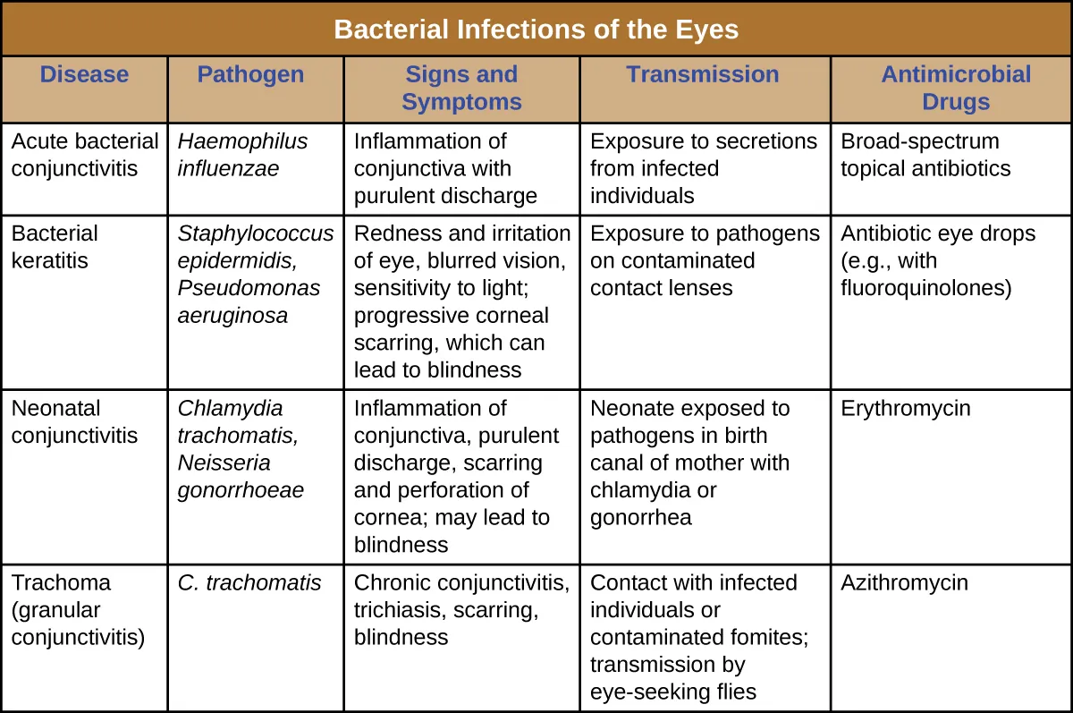 Table titled: Bacterial Infections of the Eyes. Description below.