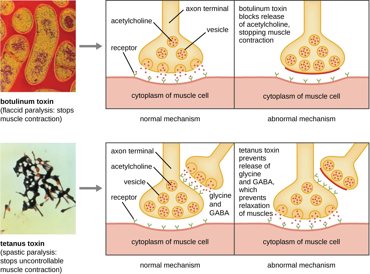 Botulinum toxin and tetanus. Description below.