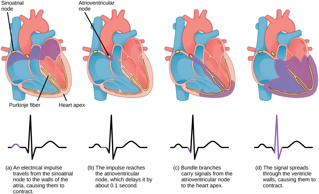 The sinoatrial node is located at the top of the right atrium, and the atrioventricular node is located between the right atrium and right ventricle. The heart beat begins with an electrical impulse at the sinoatrial node, which spreads throughout the walls of the atria, resulting in a bump in the ECG reading. The signal then coalesces at the atrioventricular node, causing the ECG reading to flat-line briefly. Next, the signal passes from the atrioventricular node to the Purkinje fibers, which travel from the atriovenricular node and down the middle of the heart, between the two ventricles, to the apex (the bottom of the heart), then up the sides of the ventricles. As the signal passes down the Purkinje fibers the ECG reading falls. The signal then spreads throughout the ventricle walls, and the ventricles contract, resulting in a sharp spike in the ECG. The spike is followed by a flat-line, longer than the first, then a bump.