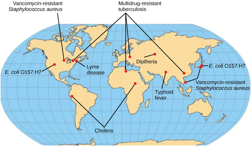 Emerging or re-emerging bacterial diseases are shown on a world map. Multidrug resistant tuberculosis is emerging in North America, Europe, north Africa, and Asia. Vancomycin resistant Staphylococcus aureus and E coli O 1 5 7 colon H 7 are emerging in North America and East Asia. Lyme disease is spreading in North America. Cholera is emerging in Africa and South America. Diptheria and typhoid fever are re emerging in Asia.