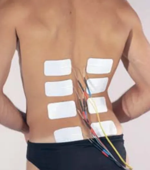 Photograph of a person with electrodes stuck on his back.