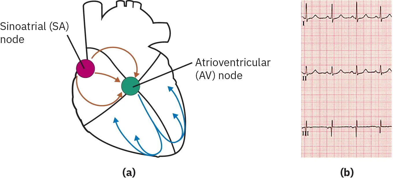 An image showing the cardiac conduction on the left side and the associated rhythm from the ECG on the right side.