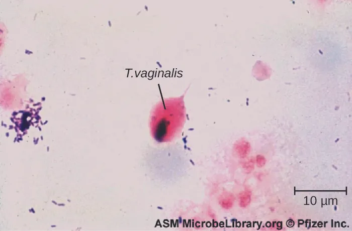 Micrograph of small purple cells and larger oval cells.