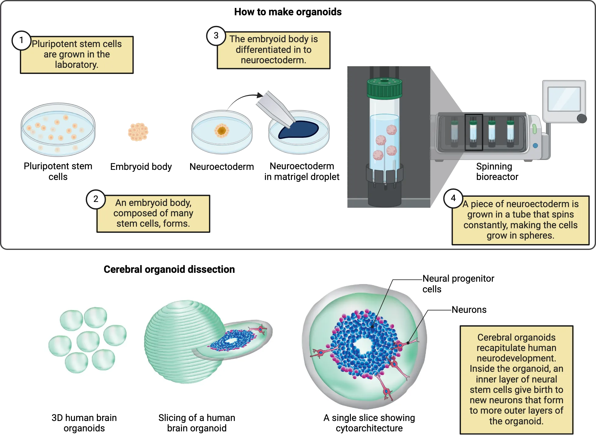 op half of image is a step-by-step diagram of how to make organoids. The steps shown are described in the main text. The bottom half is an illustration of a cerebral organoid as a sphere, from which a middle slice is extracted. The middle slice is shown as a thick donut shape, with neural progenitor cells around the inner hollow part and neurons moving towards the outer edges, as discussed in the main text.