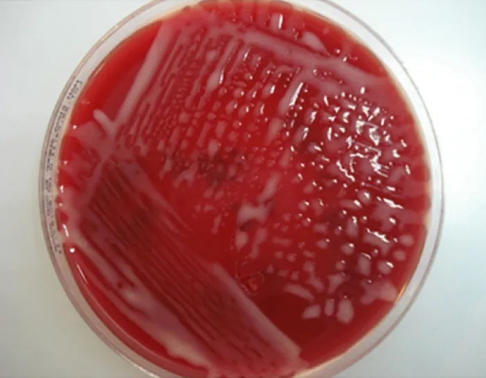 An image of a sputum.