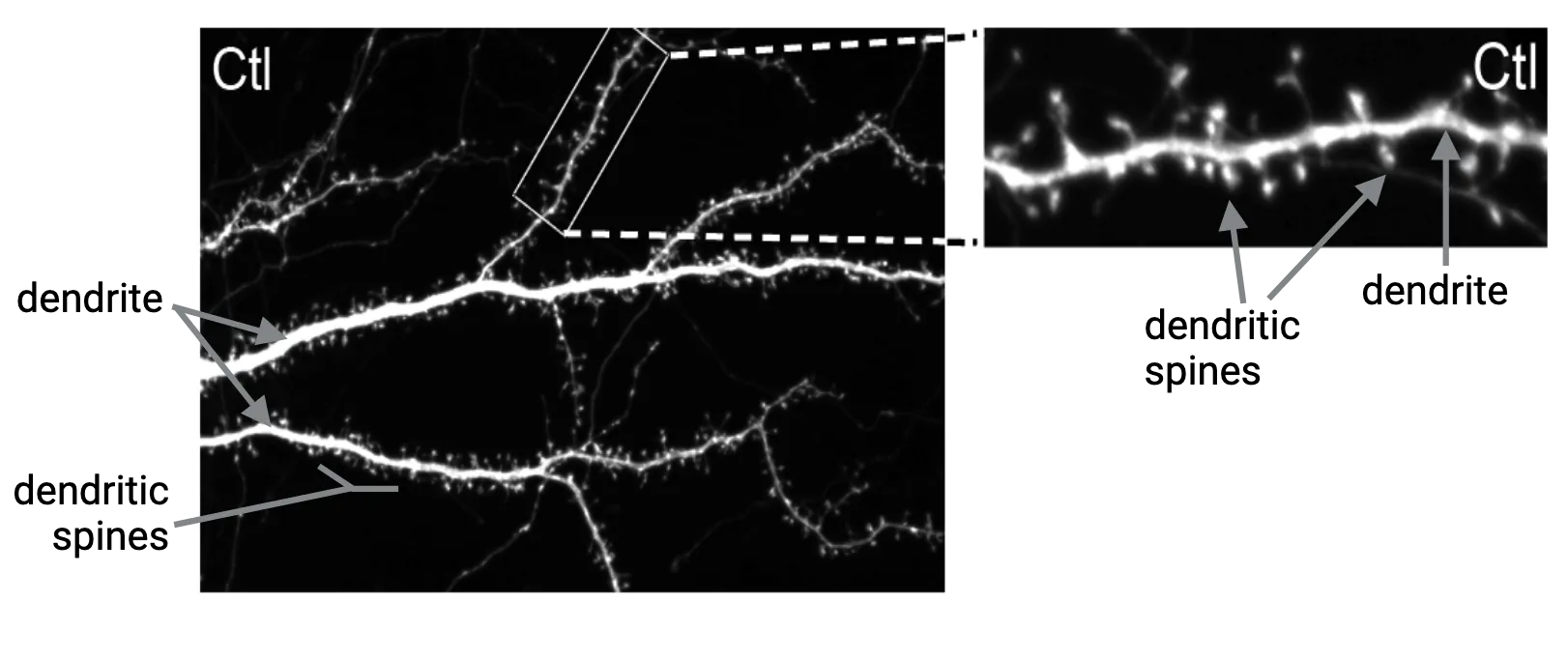 Microscopy images of several dendrites covered in spines. Spines are different shapes and sizes. 