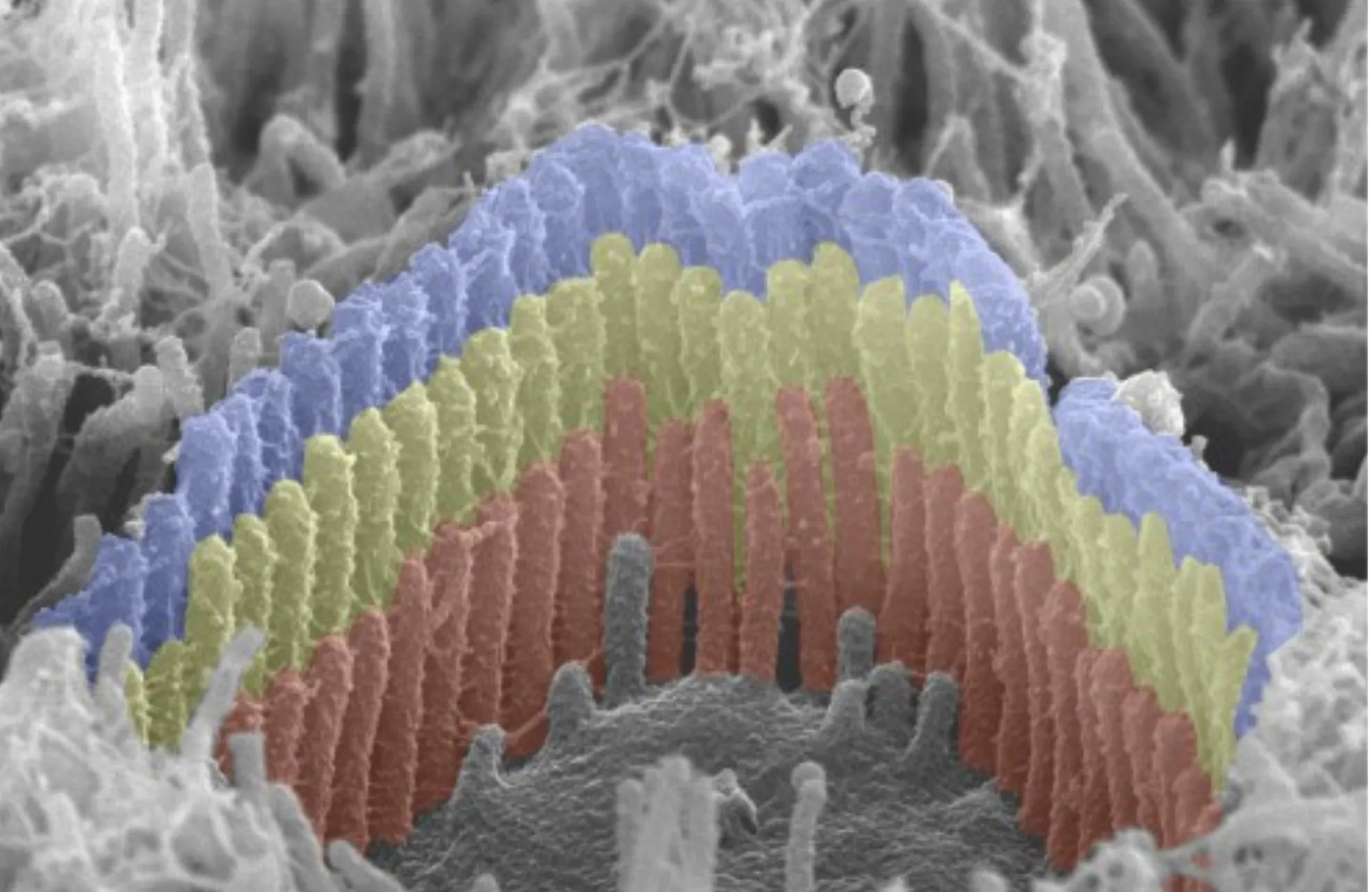 Scanning electron microscopy image showing the tip links between hair cells.