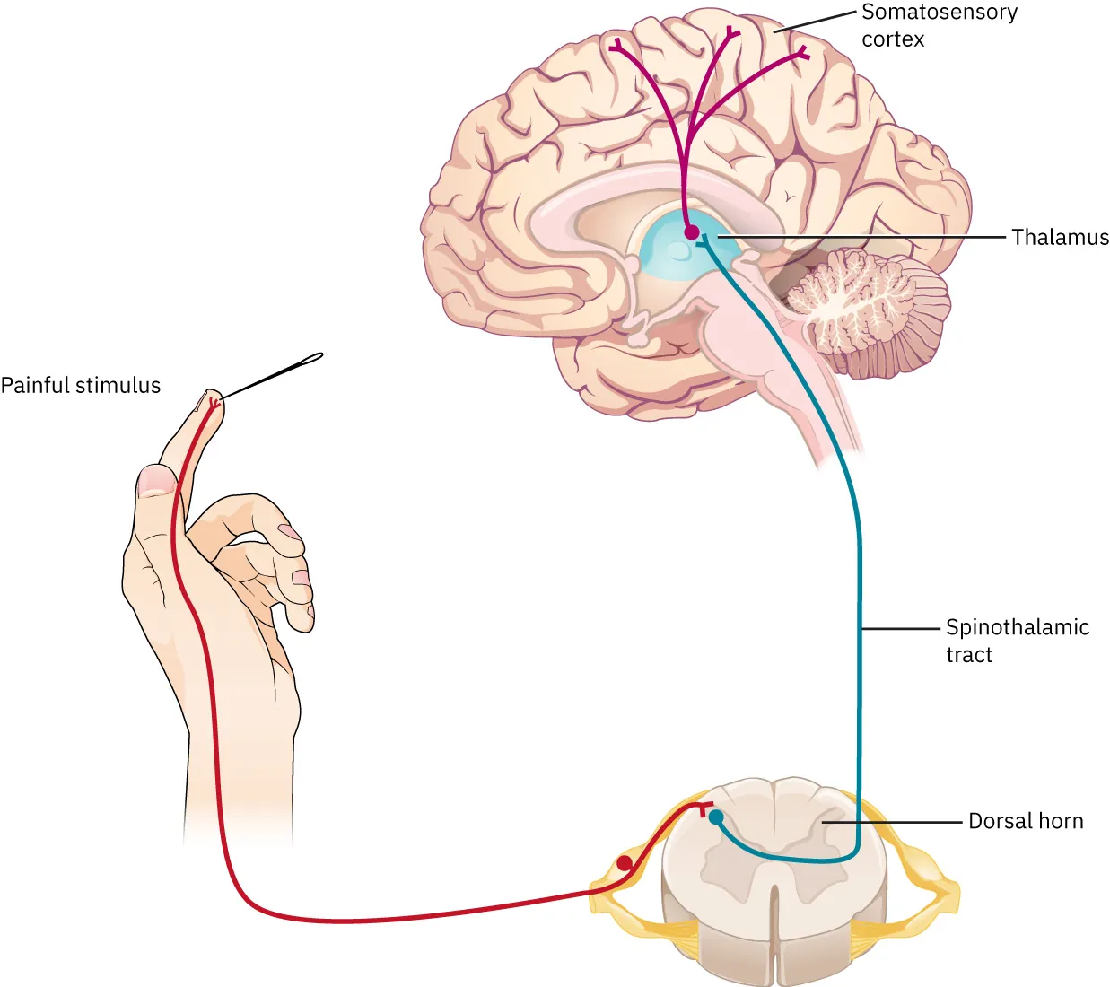 Illustration of hand being pricked by needle (pain stimulus), leading to Dorsal horn in spine, up the Spinothalamic tract, up to the Thalamus and radiating through the brain to the Somatosensory cortex.