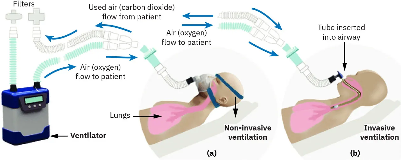 Diagram showing ventilator supporting patient's breathing, labeling ventilator, filters; (a) non-invasive ventilation, lungs, air (oxygen) flow to patient, used air (carbon dioxide) flow from patient; (b) invasive ventilation, tube inserted into airway.