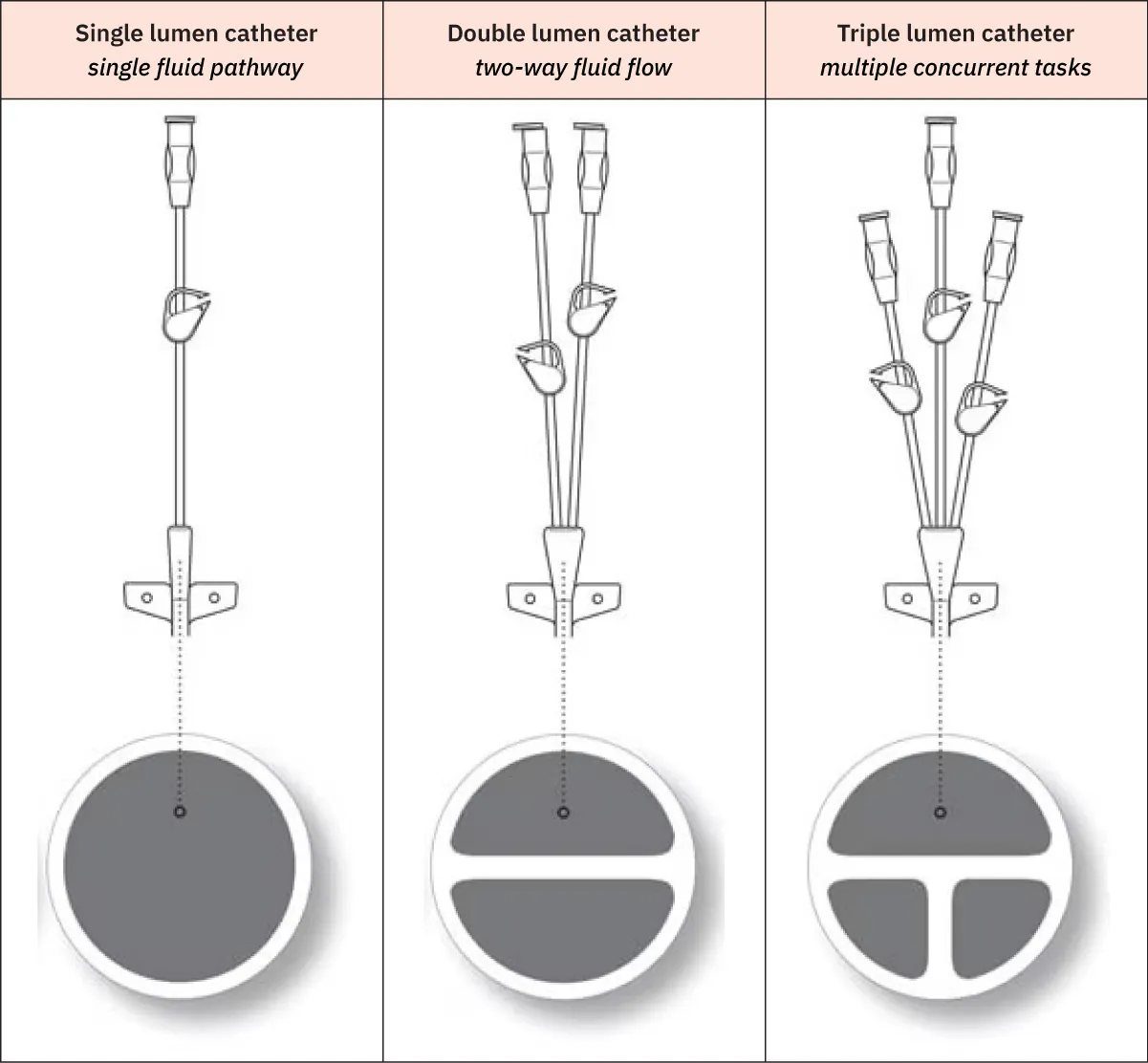 An image showing different types of catheters: single lumen, double lumen, and triple lumen.