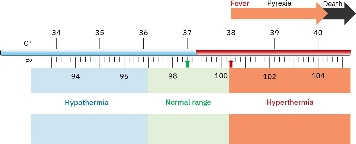Temperature ranges shown with Hypothermia labeled as below 97 degrees F/ approximately 36.1 degrees C, Normal range labeled as between hypothermia and 100.4 degrees F/38 degrees C, Hyperthermia labeled as above Normal range; Progression from Fever to Pyrexia to Death labeled in Hyperthermia range.