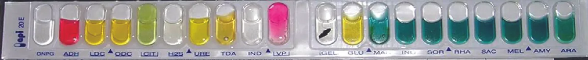 A strip with bubbles containing liquids. DNPG is clear. ADH is pink. LDC is yellow, ODC is yellow. Cit is green. H2S is clear. URE is yellow. TDA is yellow IND is white. VP is ping. GEL has a black streak. GLU is yellow. MA is green. IND is green. SOR is green. RHA is green. SAC is green. MEL is green. AMY is green ARA is green.