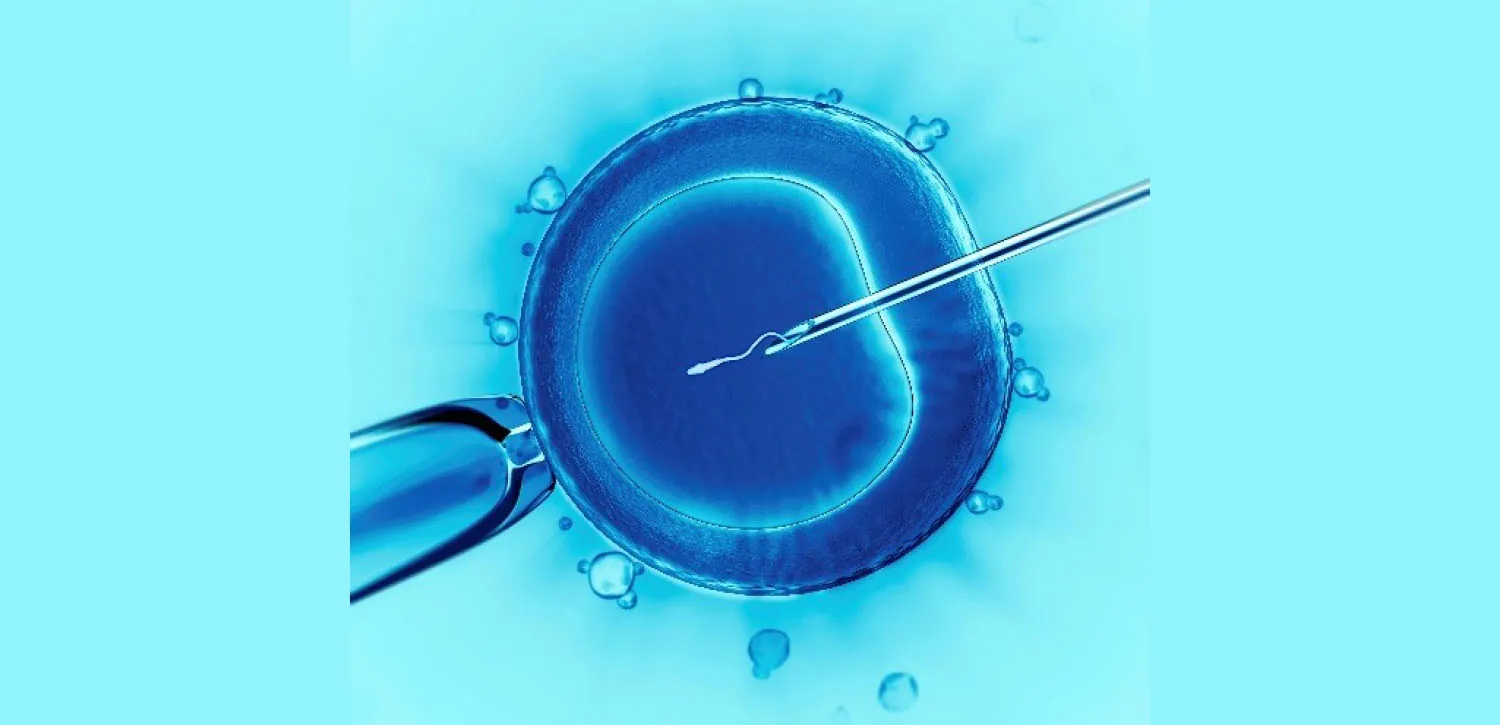 Image of sperm being injected into the ovum with a needle.