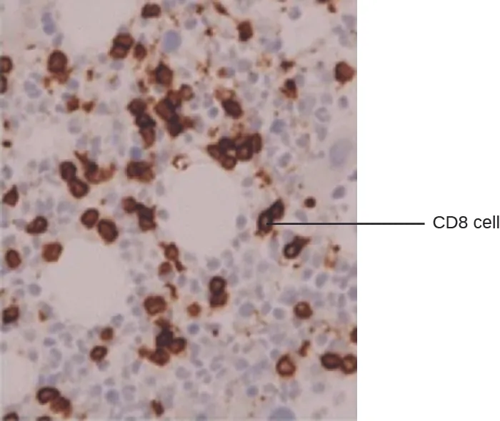 A micrograph of brown circular cells labeled CD8 cells.