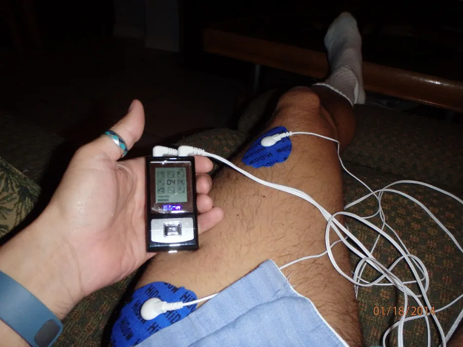 Photo of two TENS therapy pads attached to a leg and connected to small machine with buttons.