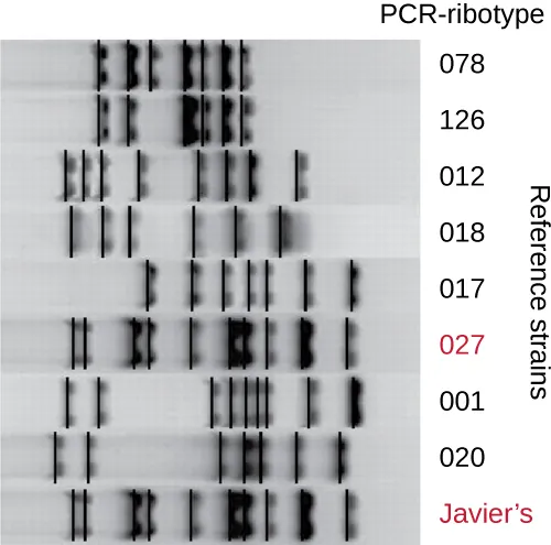 A gel showing various bands of various PCR-ribotypes. The bottom lane is labeled Javier’s an matches the banding pattern from PCR-ribotype 027.