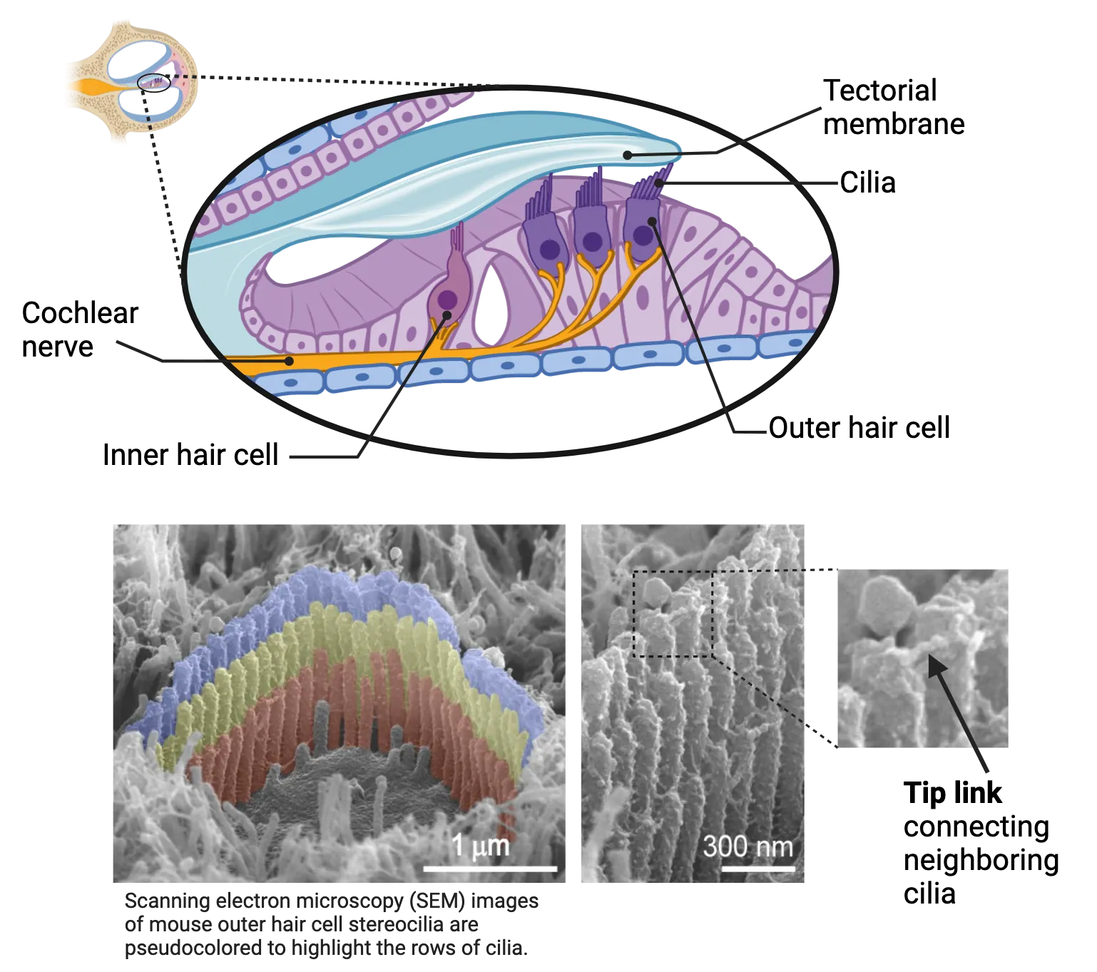 Top: Diagram of organ of corti in detail, showing hair cells abutting the tectorial membrane. Cilia are shown in inner and outer hair cells. Bottom: Scanning electron microscopy image showing the tip links between hair cells.