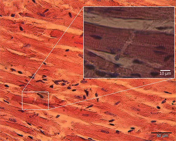 Micrograph shows cardiac muscle cells, which are oblong and have prominent striations.