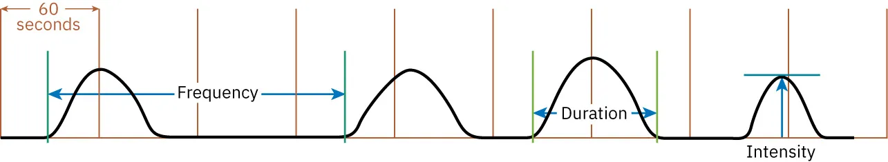 Chart labeled in 60 second intervals depicting frequency, duration, and intensity of contractions.