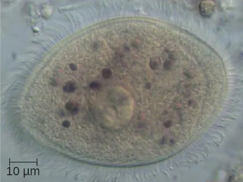 A micrograph of an oval cell with many short projections.
