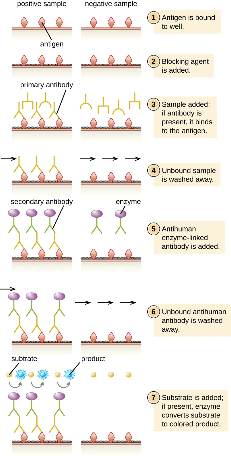 Diagram of indirect ELISA showing what happens in both a positive and a negative sample. First the antigens are bound to the well. This is shown as diamonds on a surface of both the positive and negative wells. Next, blocking agent is added. This is shown as a black covering on the surface between the antigens. Next, the sample is added. If the correct antibody is present it binds to the antigen. This is shown as Ys in both the positive and negative wells. Otherwise, nothing binds to the antigen. Next, any unbound sample is washed away. In the positive well, there is an antibody bound to the antigen, in the negative well, there is nothing bound to the antigen. Next, anti-human enzyme-linked antibody is added. This is shown as a Ys with a purple circle in both wells. Next, unbound antigen in washed away. In the positive sample this Y remains bound to the old antibody. In the negative well it is no longer present. Finally, substrate is added to both wells. In the positive well, the enzyme changes the substrate to a blue color.