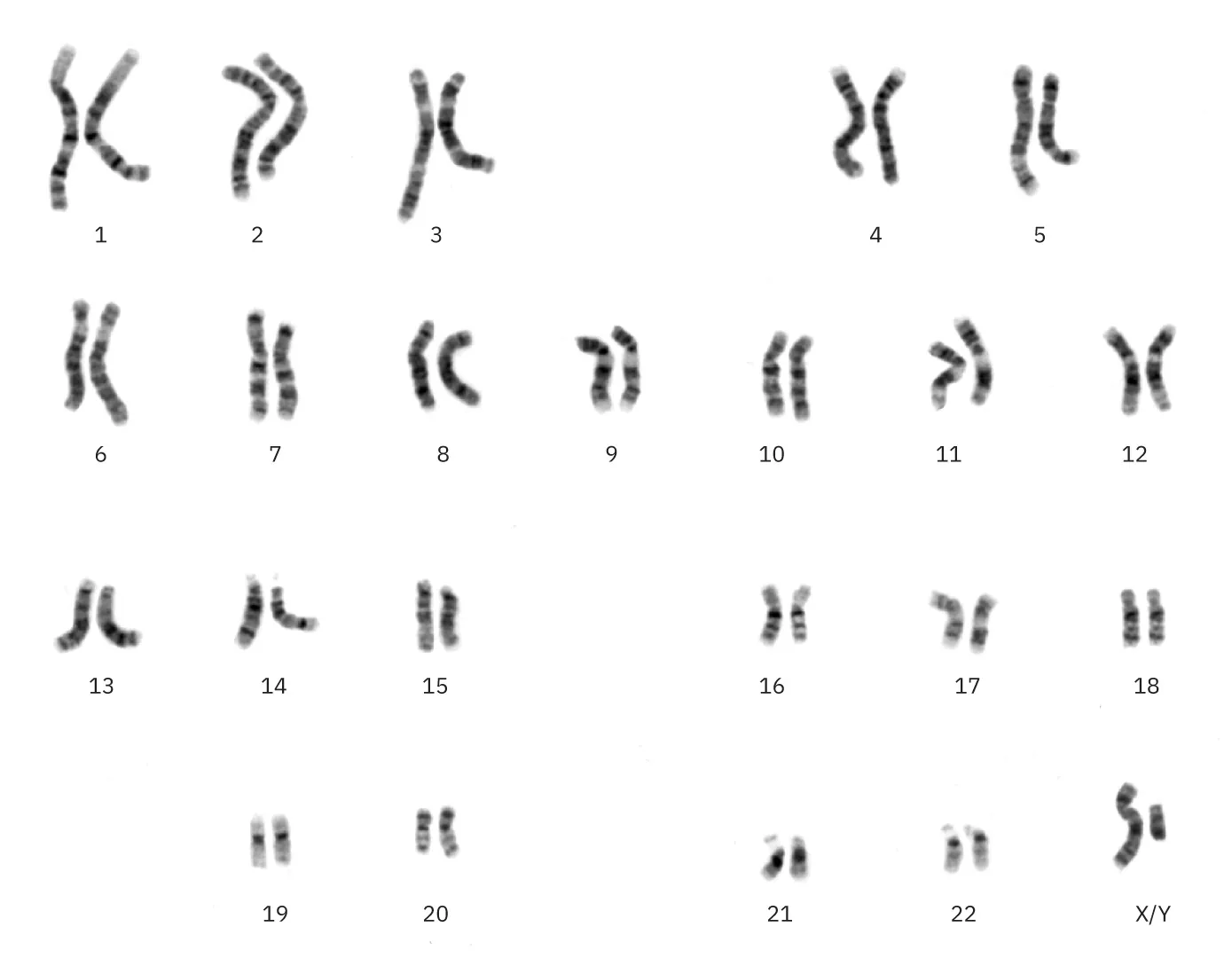 Image of autosomes (body cell chromosomes) and sex chromosomes (XX or XY).