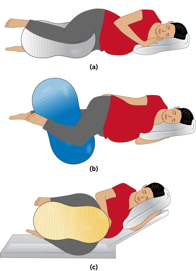 Peanut ball positions: (a) Side lying, upper leg elevated; knees slightly bent. (b) Side lying; upper leg bent at knee/hanging over; lower leg straight/slightly bent. (c) Side lying; legs straddling; knees bent.
