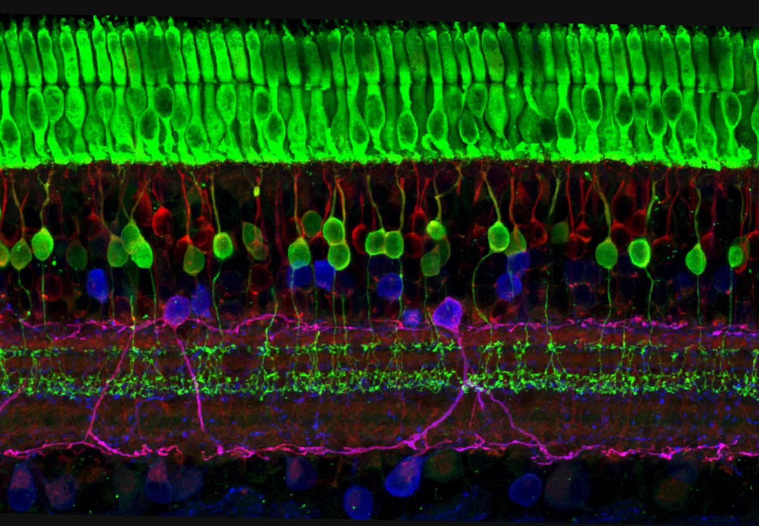 A micrograph shows the layers of nerve cells in the retina. The top layer (green) is made up of cells called photoreceptors that convert light into electrical signals to relay to the brain.
