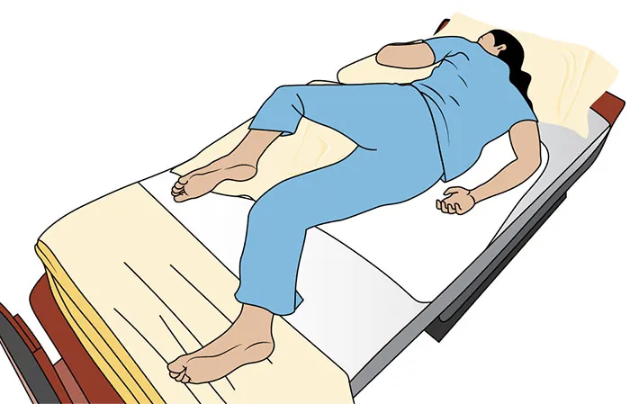 An illustration of a patient lying in Sims position on a cot.
