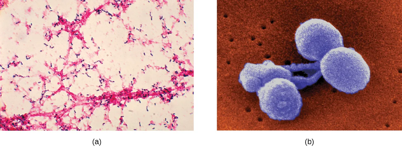 part a shows a micrograph of lancet (football) shaped cells, some of which have a clear ring around them. Part b shows two dumbbell shaped blue cells on an orange background.