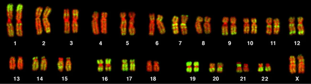 Image of a full set of twenty-three pairs of chromosomes, labeled 1-22 and the last one labeled X.