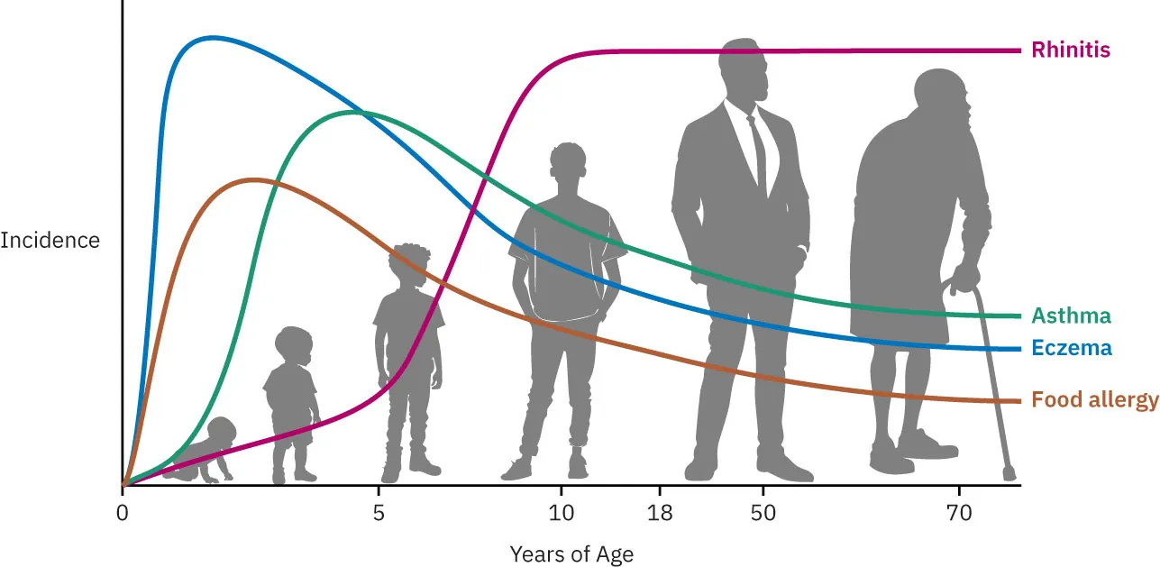 Graph showing incidence of Rhinitis (lower in toddlers, increasing around age 5 and through adulthood), Asthma, Eczema and Food allergy (high in childhood, decreasing after age 5) through the lifespan.