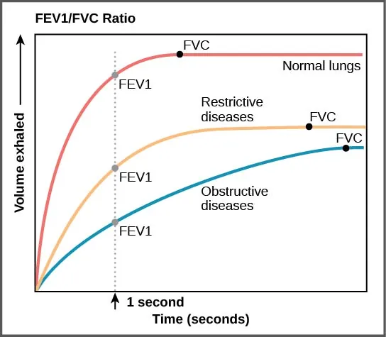 The graph plots volume exhaled versus time. In normal lungs, almost all of the air can be forcibly exhaled within one second after taking a deep breath, resulting in a curve that rises steeply at first then plateaus shortly after one second. The volume after 1 second is the F E V 1, and it is almost as high as the volume at which the plateau is reached, which is the F V C. In lungs of persons with restrictive lung disease, the F V C is considerably lower but the person can exhale reasonably fast, resulting in a curve that is similar in shape, but with a lower plateau, or F V C, than for normal lungs. The F E V 1 value is still a significant proportion of the F V C value.  In lungs of persons with obstructive lung disease, the F V C is low and exhalation is much slower, resulting in a flatter curve with a lower plateau. The slower exhalation results in a F E V 1 value much lower than the F V C value.