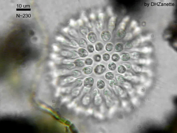 A micrograph shows a colonial Choanoflagellate. It appears to be a central structure with a series of circular cells on its surface.