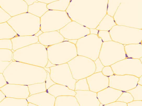 Illustration shows irregularly shaped cells with tiny nuclei clustered next to the cell’s outer membrane.