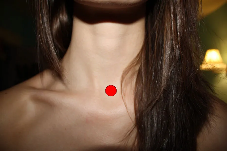 Image showing the location of the suprasternal notch