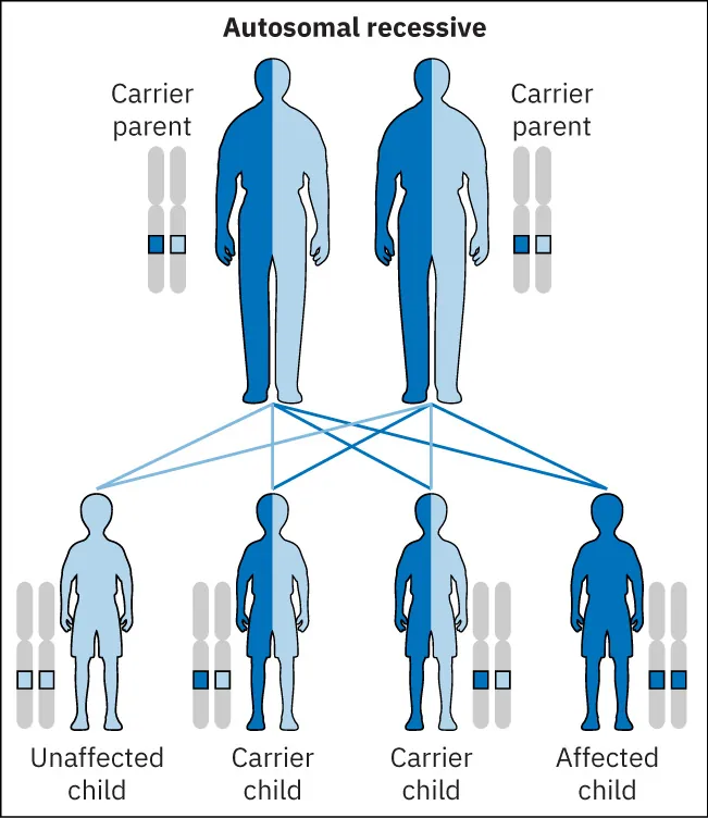 Chart showing how Autosomal recessive Carrier parents combine into Unaffected child and Carrier child.