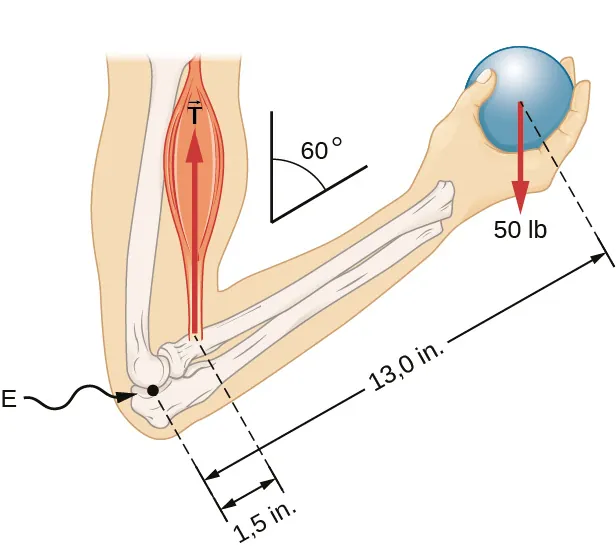 La figura es el esquema de un antebrazo, rotado alrededor del codo. Se sostiene una pelota de 50 libras en la palma de la mano. La distancia entre el codo y la pelota es de 13 pulgadas. La distancia entre el codo y el músculo bíceps, que provoca un torque alrededor del codo, es de 1,5 pulgadas. El antebrazo forma un ángulo de 60 grados con el brazo.