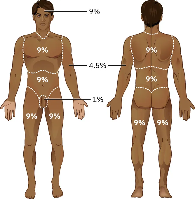 Diagram demonstrating Rule of Nines, labeling anterior and posterior regions with percentages.