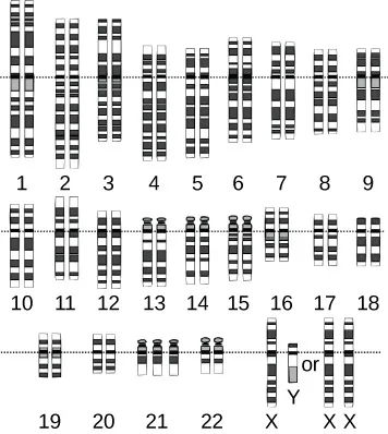The image shows a karyotype of a human with 22 somatic chromosomes and the sex chromosomes appropriate to being either male or female. The space for Chromosome 21 has three chromosomes. All of the other spaces for chromosomes have two chromosomes