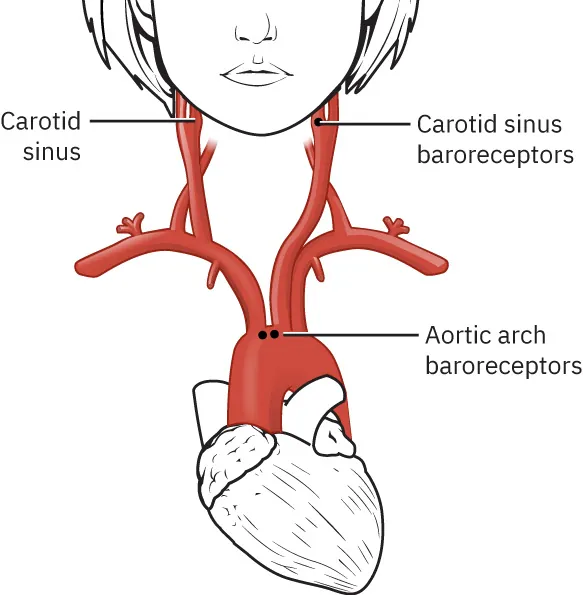Diagram showing carotid sinus, carotid sinus baroreceptors, and aortic arch baroreceptors