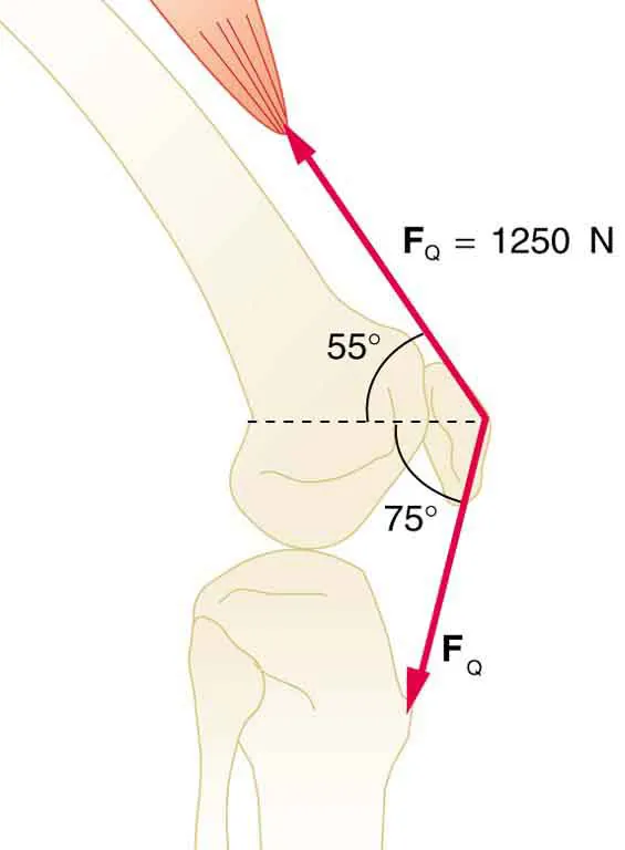 The figure shows a side view of the bones of a knee and the quadriceps muscle. The upper bone is inclined at fifty five degrees to the horizontal and the tension exerted by the quadriceps muscle is one thousand two hundred and fifty newtons. The tendon from the knee cap to the lower bone is inclined at seventy five degrees below the horizontal. The force in this direction is the same as that provided by the quadriceps.