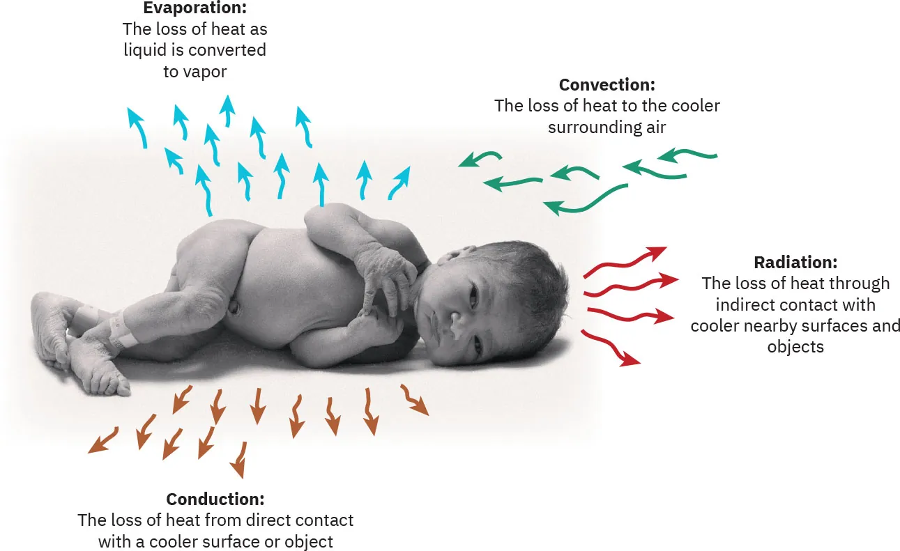 Diagram showing types of heat transfer from a newborn. Evaporation is the loss of heat as liquid is converted to vapor. Convection is the loss of heat to the cooler surrounding air. Radiation is the loss of heat through indirect contact with cooler nearby surfaces and objects. Conduction is the loss of heat from direct contact with a cooler surface or object.