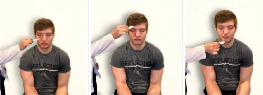 Photos of simulated patient being assessed for trigeminal sensory function