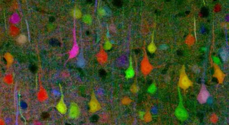 A Brainbow, where each individual neuron stands out due to a different shade of color.