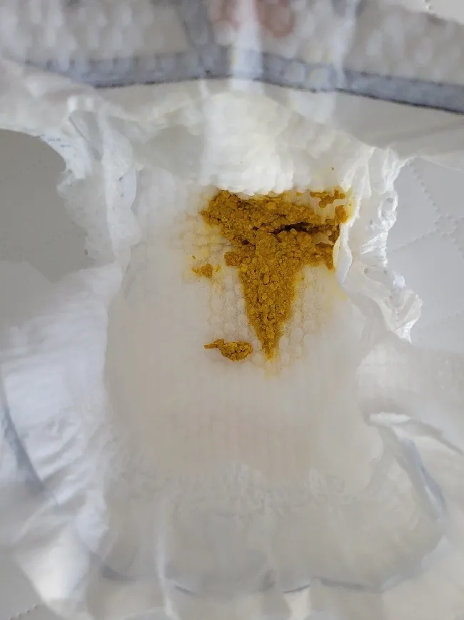 Photo of stool from a breast-fed infant.