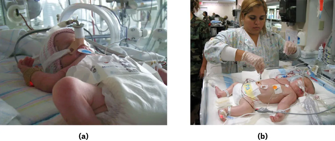 (a) Photograph shows a newborn in a neonatal intensive care unit with various medical devices attached. (b) Photograph depicts a healthcare worker attending to a newborn in a neonatal intensive care unit.