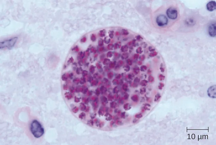 Micrograph of sphere wit red dots.