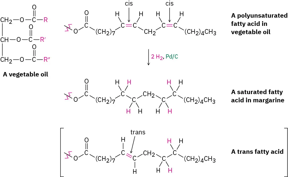 Catalytic hydrogenation of a polyunsaturated fatty acid in vegetable oil with two molecules of hydrogen in palladium on carbon to form a saturated and trans-fatty acid in margarine.